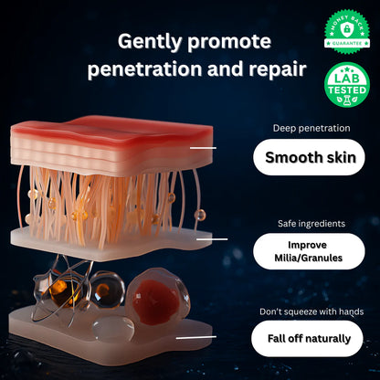 Milia Remover Treatment